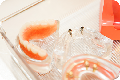 診療案内10_入れ歯(義歯)