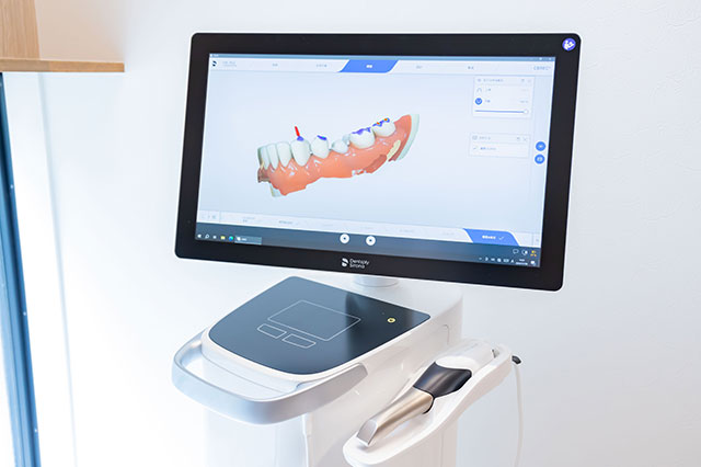 院内・設備紹介06_口腔内スキャナー